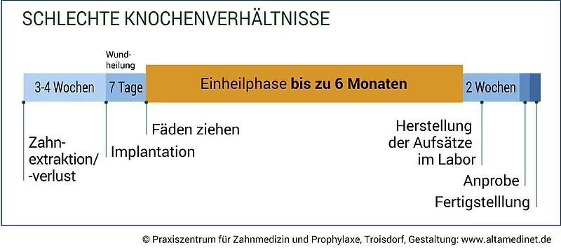 Zeitspanne bei schlechten Knochenverhältnisse